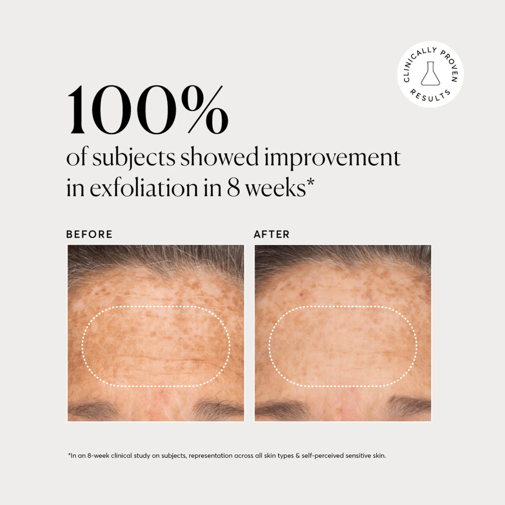 bha-liquid-exfoliant-2-e4 NATR-10027-Alt-Images-BHA-Liquid-Exfoliant-2_-03.webp