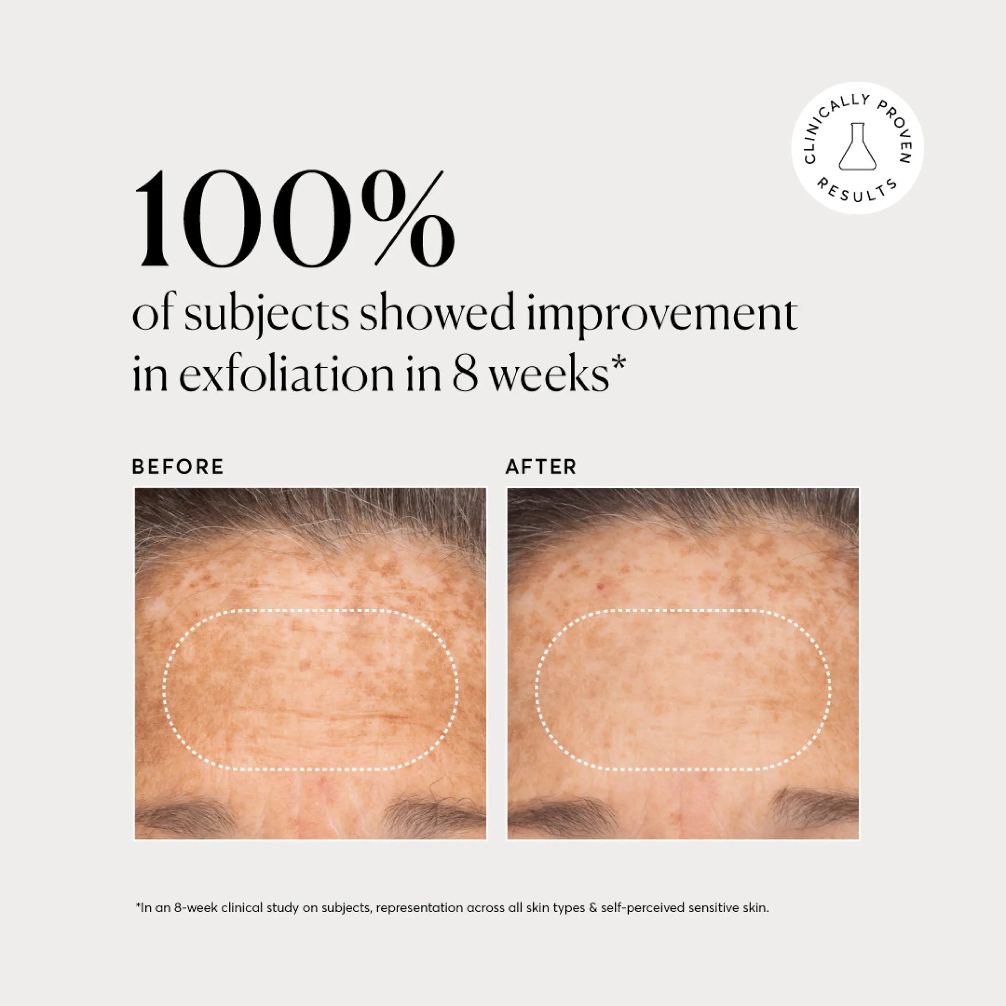 bha-liquid-exfoliant-2-e4 NATR-10027-Alt-Images-BHA-Liquid-Exfoliant-2_-03.webp
