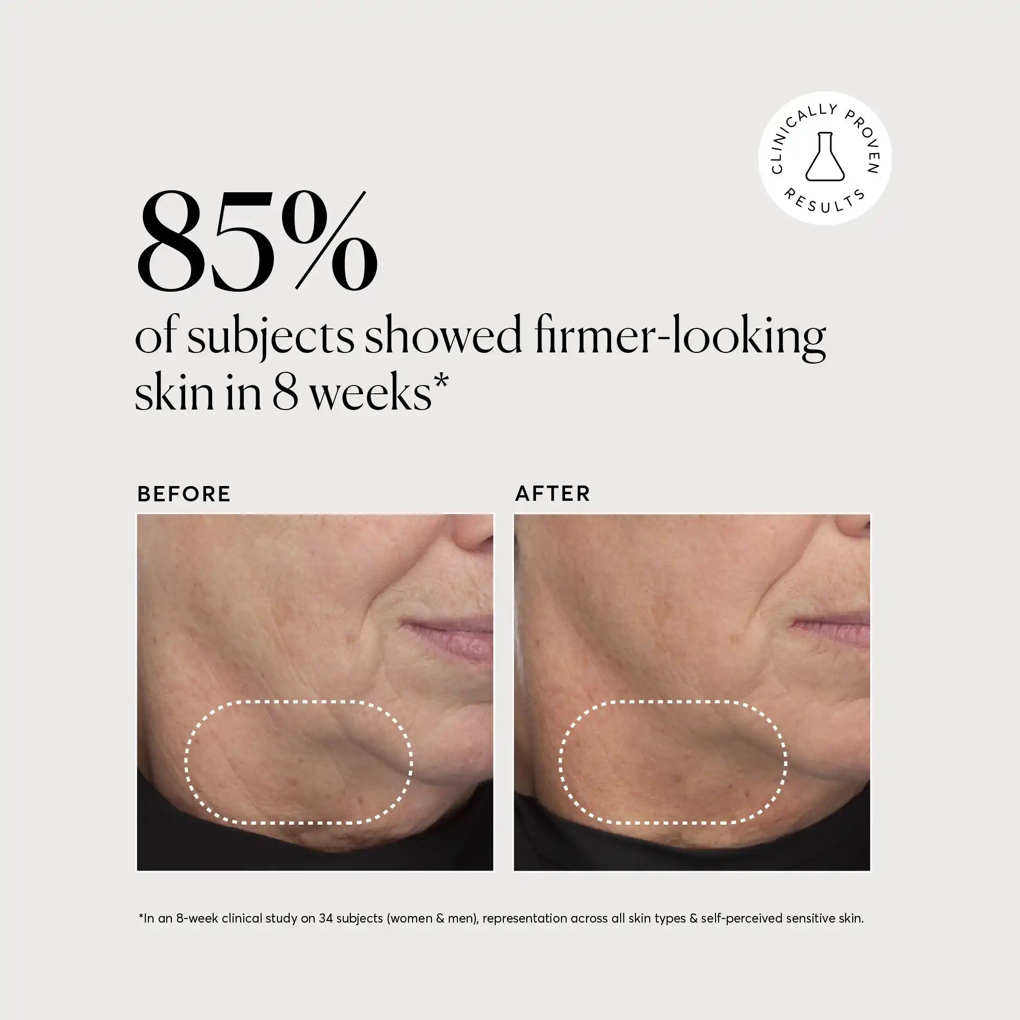 retinol-complex-serum-d3 NATR-10034-Alt-Images-Retinol-Complex-Serum-04.webp